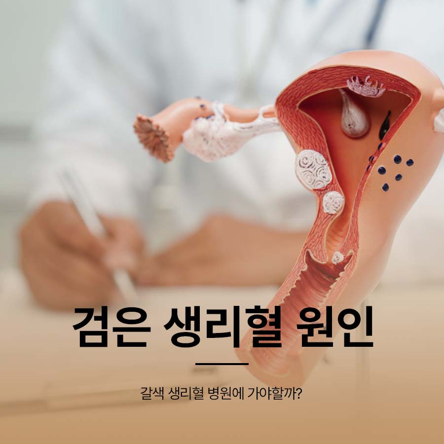 검은 생리혈 원인 갈색 생리혈 병원에 가야할까? 관련 이미지 1