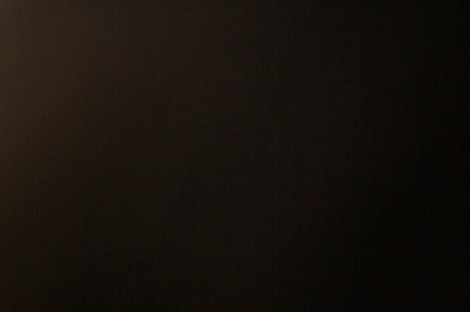 콜로디온 베이비 원인 증상 완치될 수 있나요 관련 이미지 14