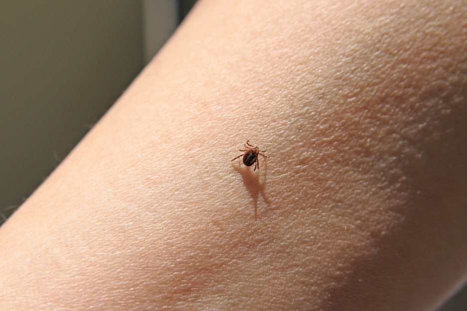This Is What a Tick Bite Looks Like! What to Do If You’re Bitten and How to Prevent It image 4