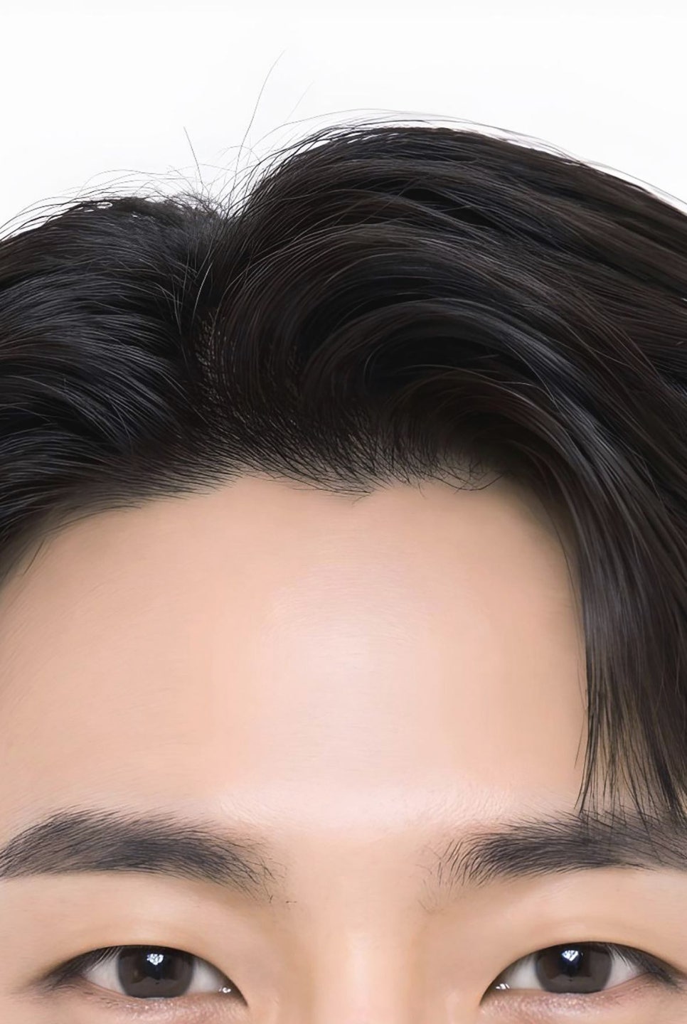 비절개 모발이식 절개와 뭐가 다를까? 선택 기준 4가지 관련 이미지 8