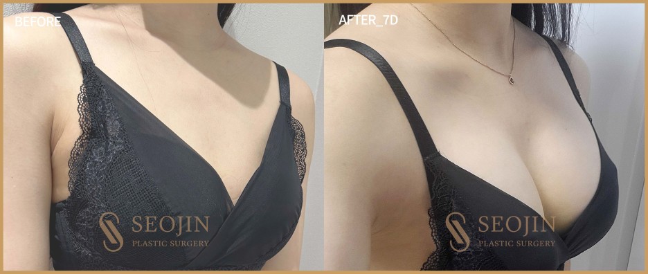 서진성형외과 성형수술 철저한 시스템으로 관련 이미지 2