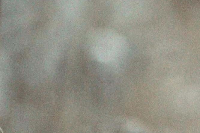 남자 모발이식수술 m자 헤어라인 개선방법 포인트 관련 이미지 25