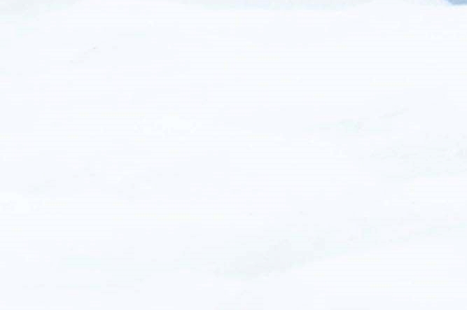 처진 가슴성형 유방하수 교정이 필요한 경우 관련 이미지 20