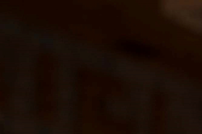 땀이 너무 많이 나요 원인 다한증 자가진단 치료방법은? 관련 이미지 8