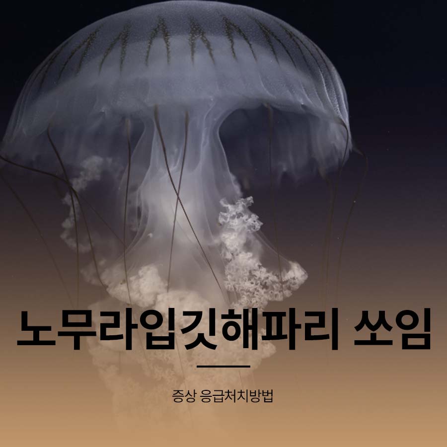 노무라입깃해파리 쏘임 증상 응급처치방법 관련 이미지 1