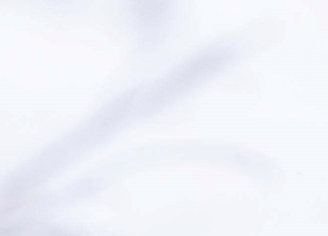 비절개 모발이식 무삭발 노컷으로 자연스러운 모습 관련 이미지 14