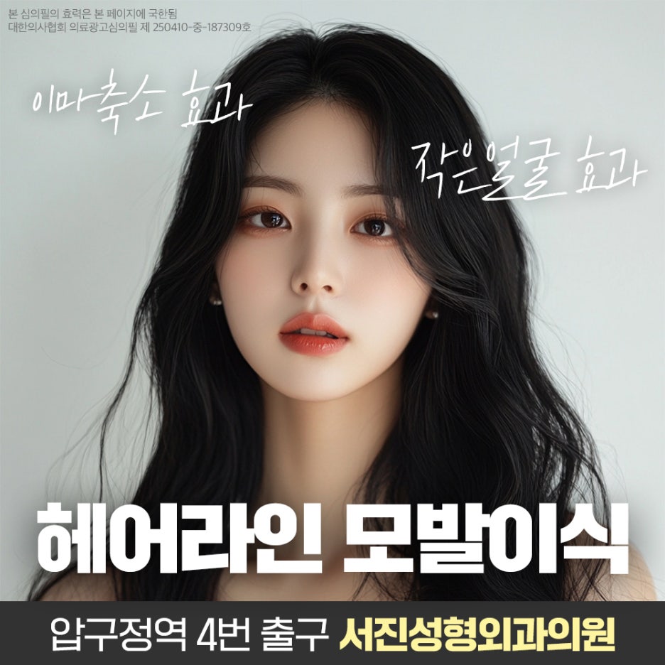 PRP 모발이식 잘하는곳 PRP뜻 과정 장점 뜯어보기 관련 이미지 4