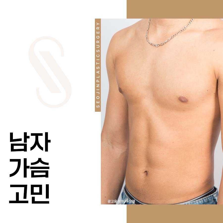 What Are the Self-Diagnosis Criteria for Male Breast Concerns and Gynecomastia? image 1