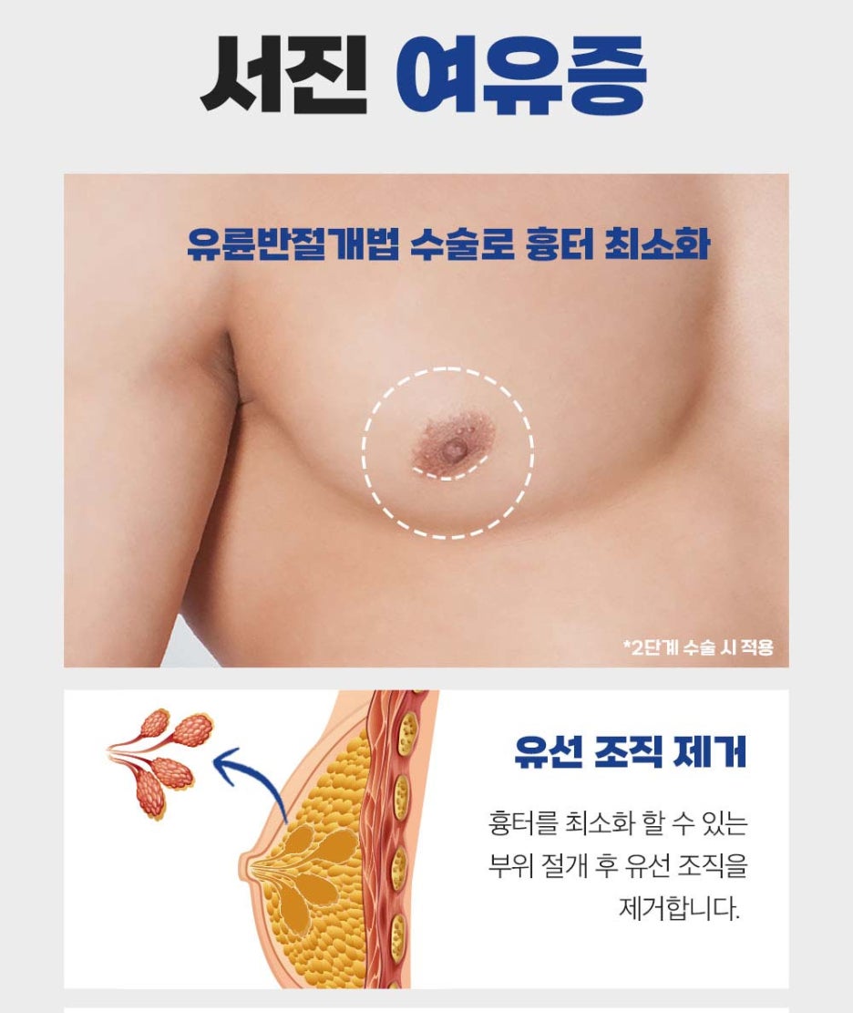 남자 가슴처짐 여유증 원인 분석이 중요해요 관련 이미지 4