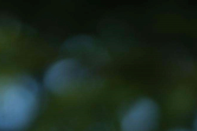 압구정역 성형외과 사후관리가 중요한 이유 관련 이미지 24
