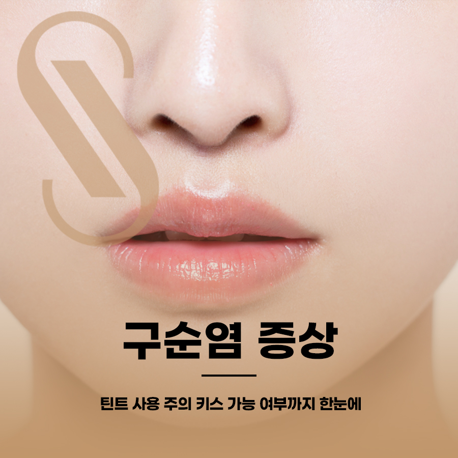 구순염 증상 틴트 사용 주의 키스 가능 여부까지 한눈에 관련 이미지 1