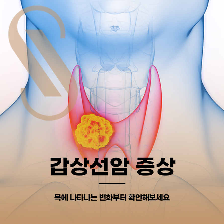 Thyroid Cancer Symptoms: Start by Checking for Changes in Your Neck image 1