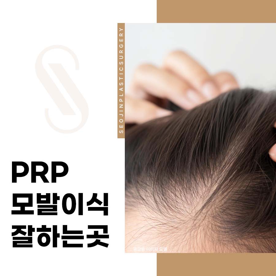 PRP 모발이식 잘하는곳 PRP뜻 과정 장점 뜯어보기 관련 이미지 1
