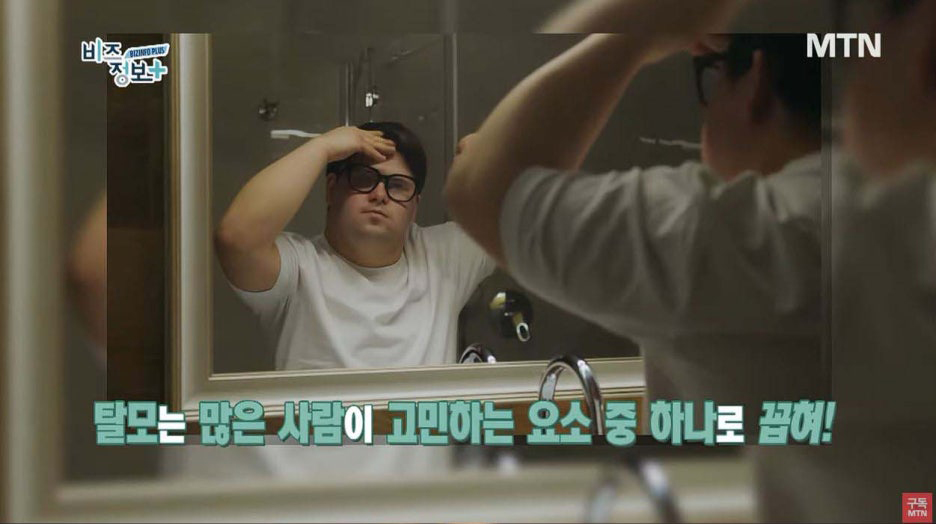 헤어라인모발이식 잘하는곳 내게 딱 맞는 비율로 관련 이미지 1