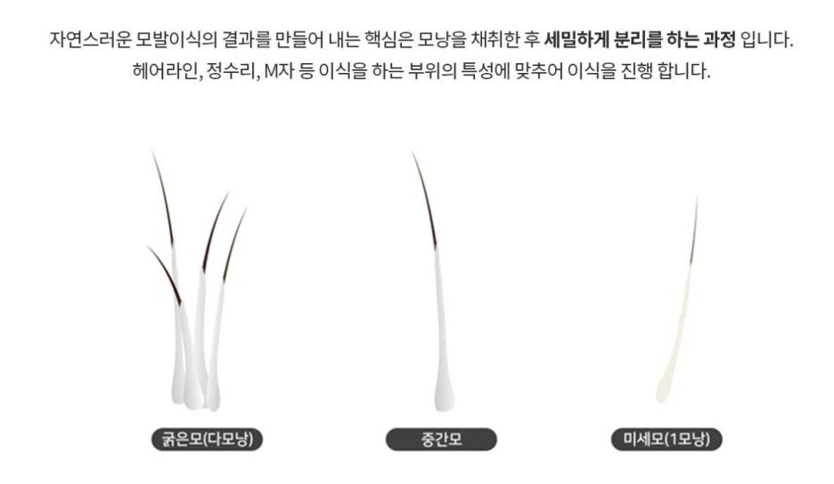 신사압구정 모발이식 생착률 디자인을 높이려면 관련 이미지 4