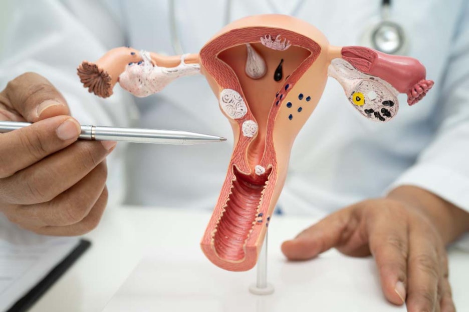 Causes of a Late Period: Understanding What Menstrual Irregularity Means image 7
