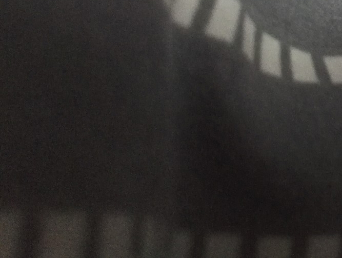 대량모발이식방법 티나지 않는 자연스러움 관련 이미지 21