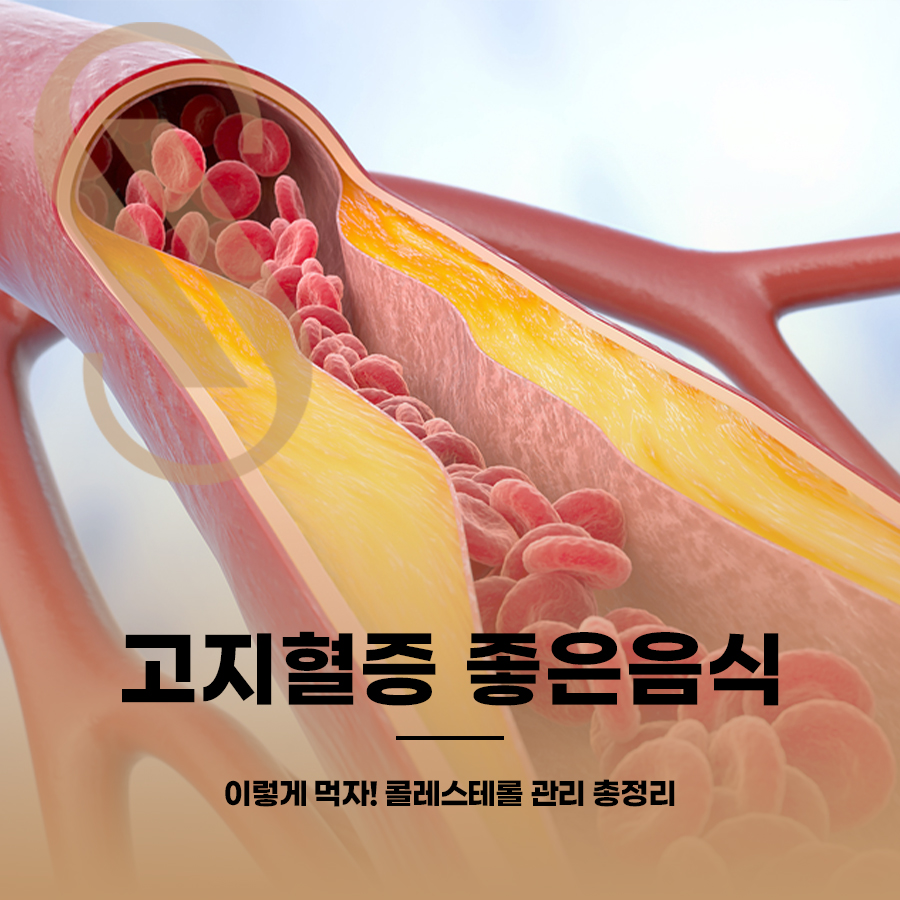 고지혈증 좋은음식 이렇게 먹자!콜레스테롤 관리 총정리 관련 이미지 1