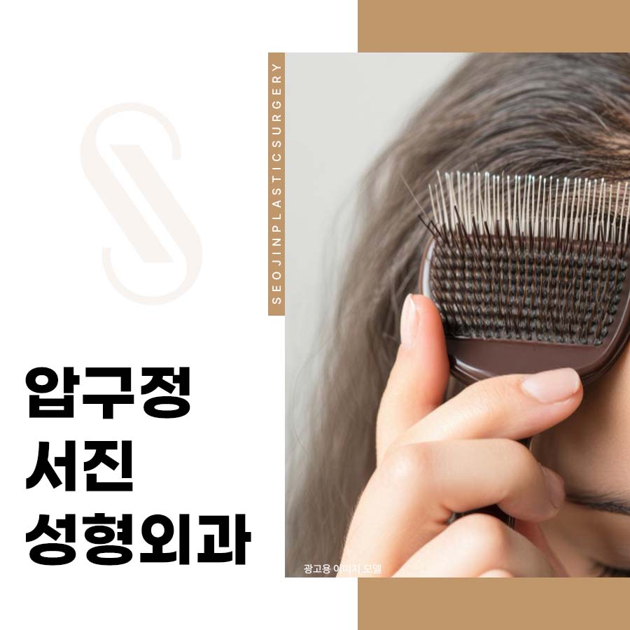 Apgujeong Seojin Plastic Surgery Hair Transplantation: Q&A You Must Know Before a Non-Incisional Procedure image 1
