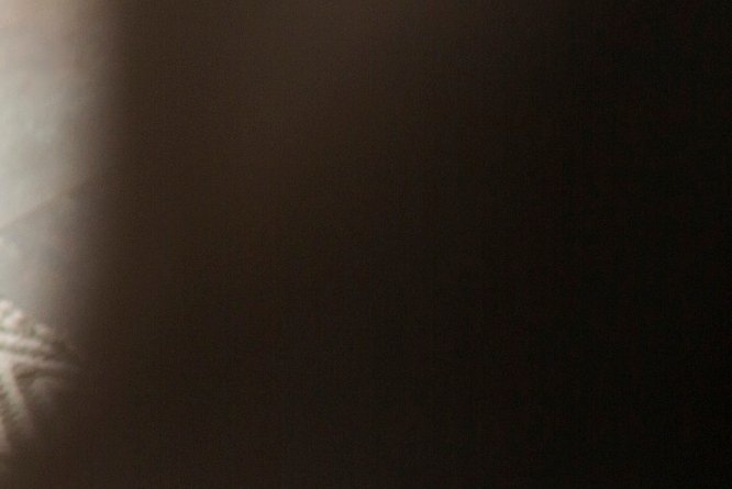 콜로디온 베이비 원인 증상 완치될 수 있나요 관련 이미지 11