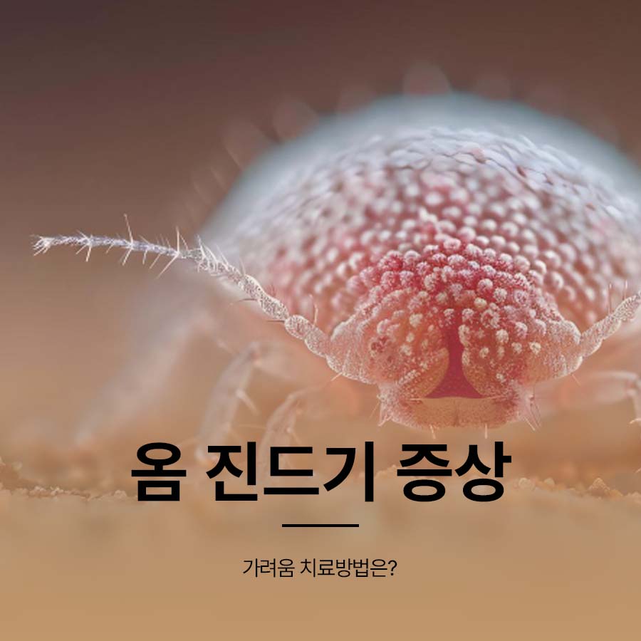 What Are the Symptoms of Scabies Mites, Itching, and Treatment Methods? image 1