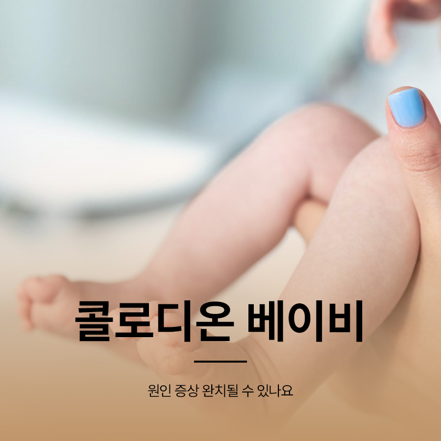 콜로디온 베이비 원인 증상 완치될 수 있나요 관련 이미지 1