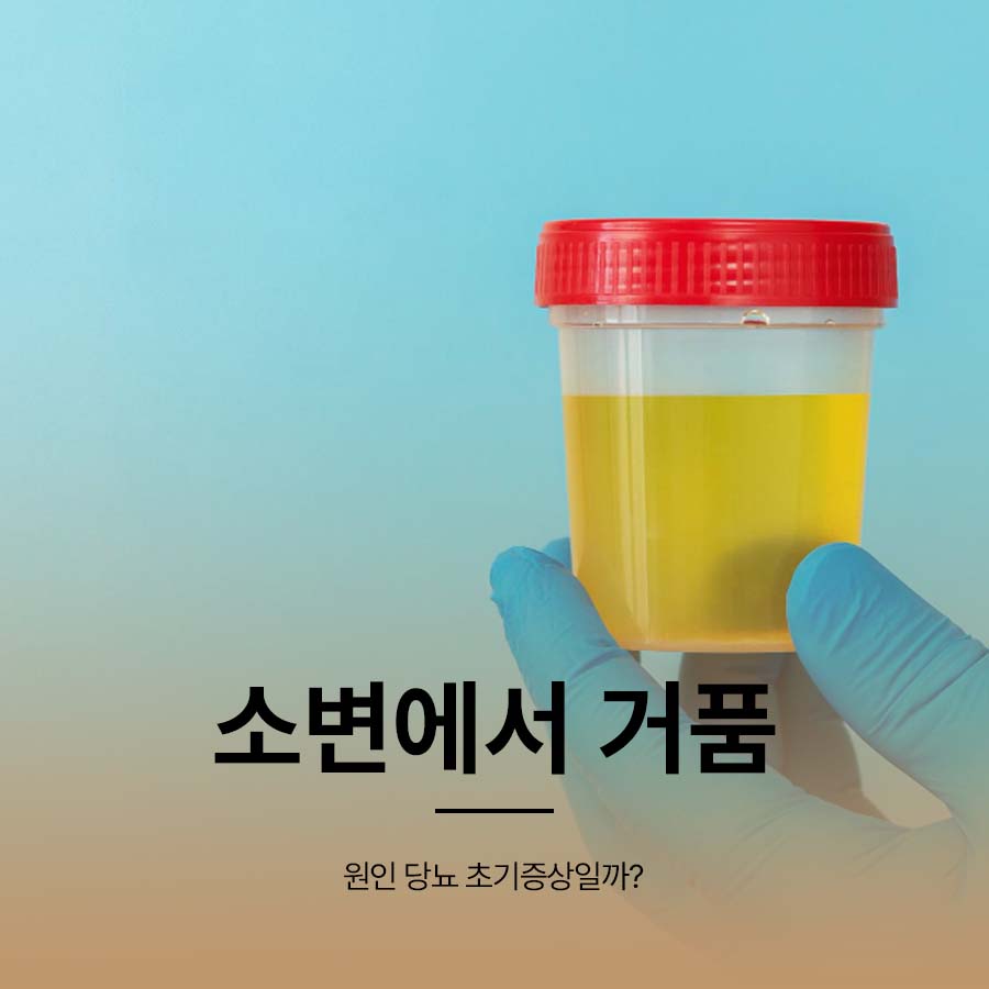 소변에서 거품 원인 당뇨 초기증상일까? 관련 이미지 1