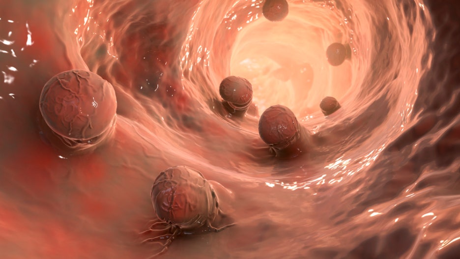 Eliminating Inflammation in the Body: Practical Ways to Reduce Chronic Inflammation image 6
