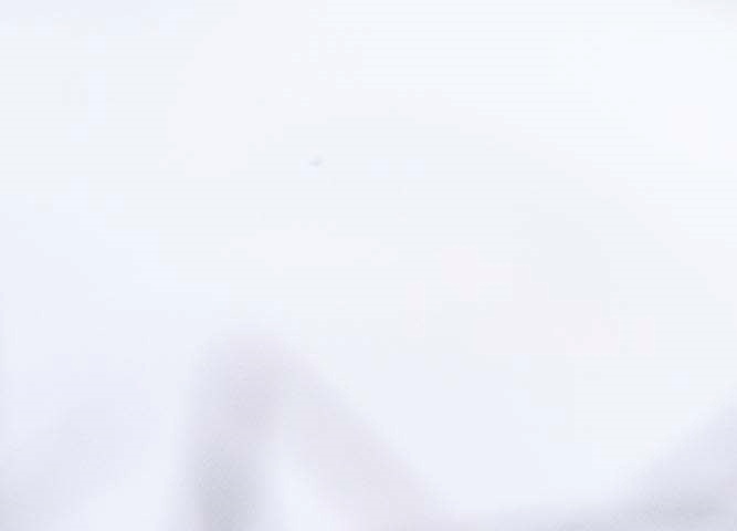 비절개 모발이식 무삭발 노컷으로 자연스러운 모습 관련 이미지 13