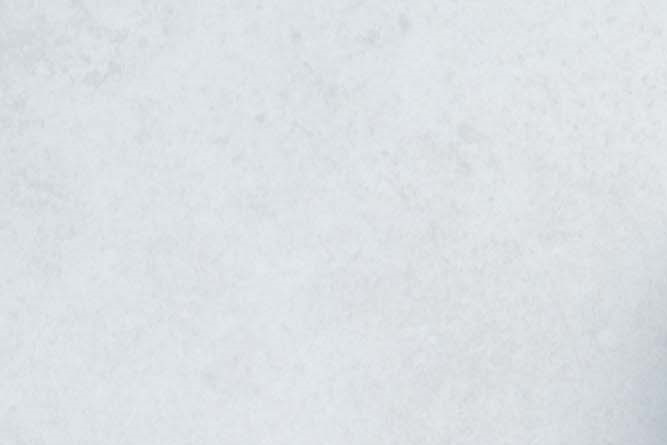 서진 모발이식수술 원리 통증 정리 관련 이미지 22