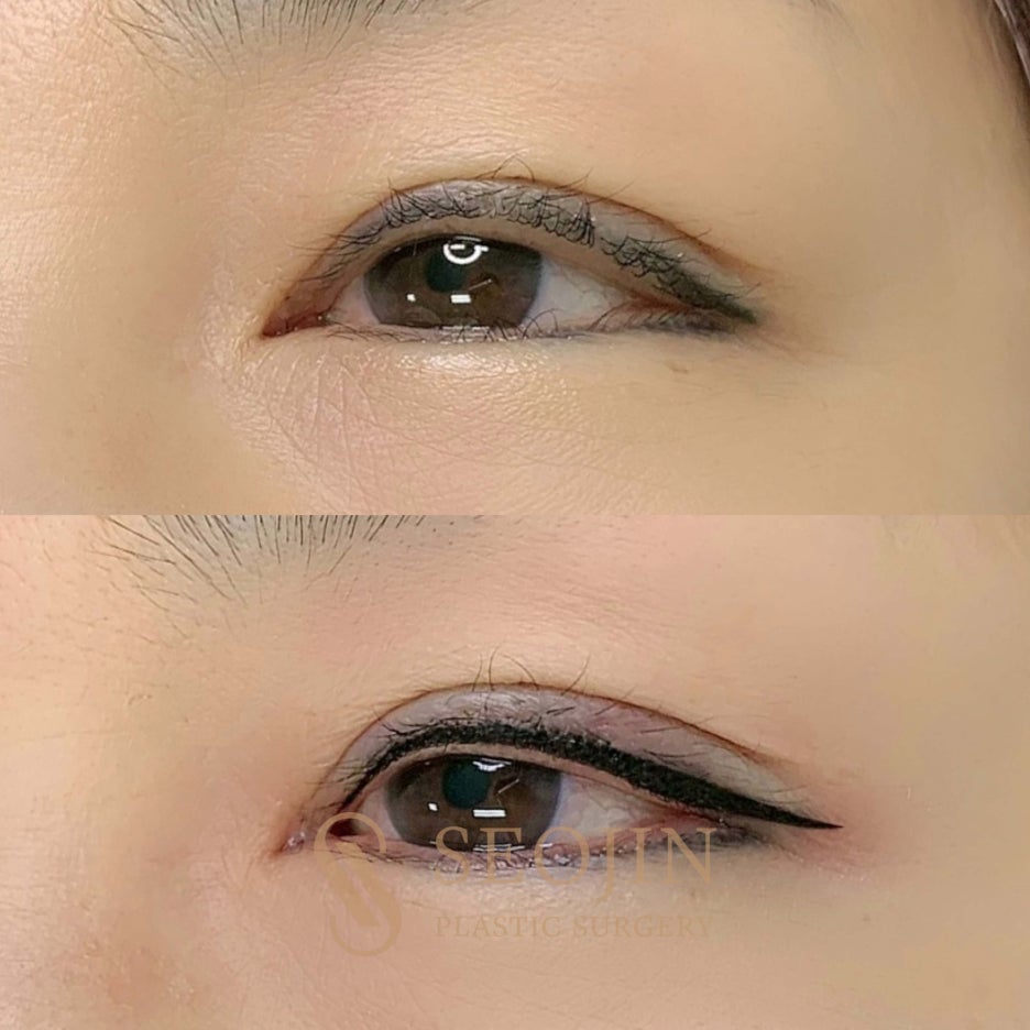 반영구눈썹문신종류 나한테 어울리는 눈썹은? 관련 이미지 5