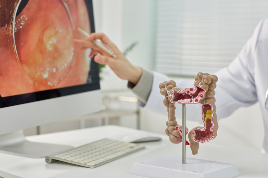Foods Before a Colonoscopy: Prepare Like This Starting 3 Days Before image 4