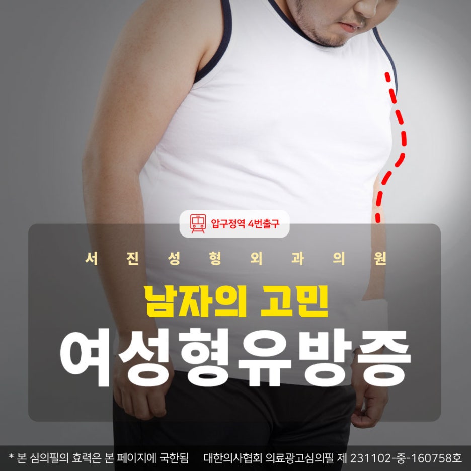 압구정역 남자여유증 수술 여성형유방증 원인 개선방법 관련 이미지 2
