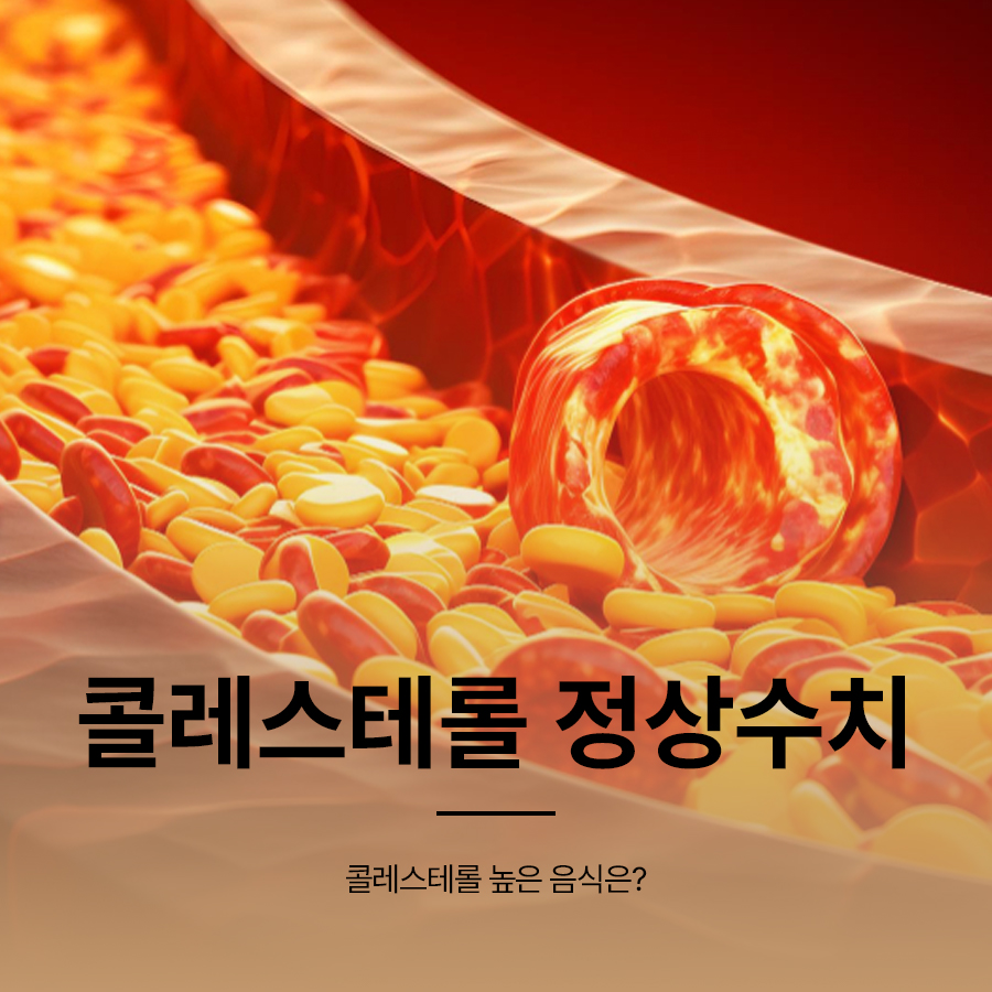 콜레스테롤 정상수치 높은 음식은? 관련 이미지 1