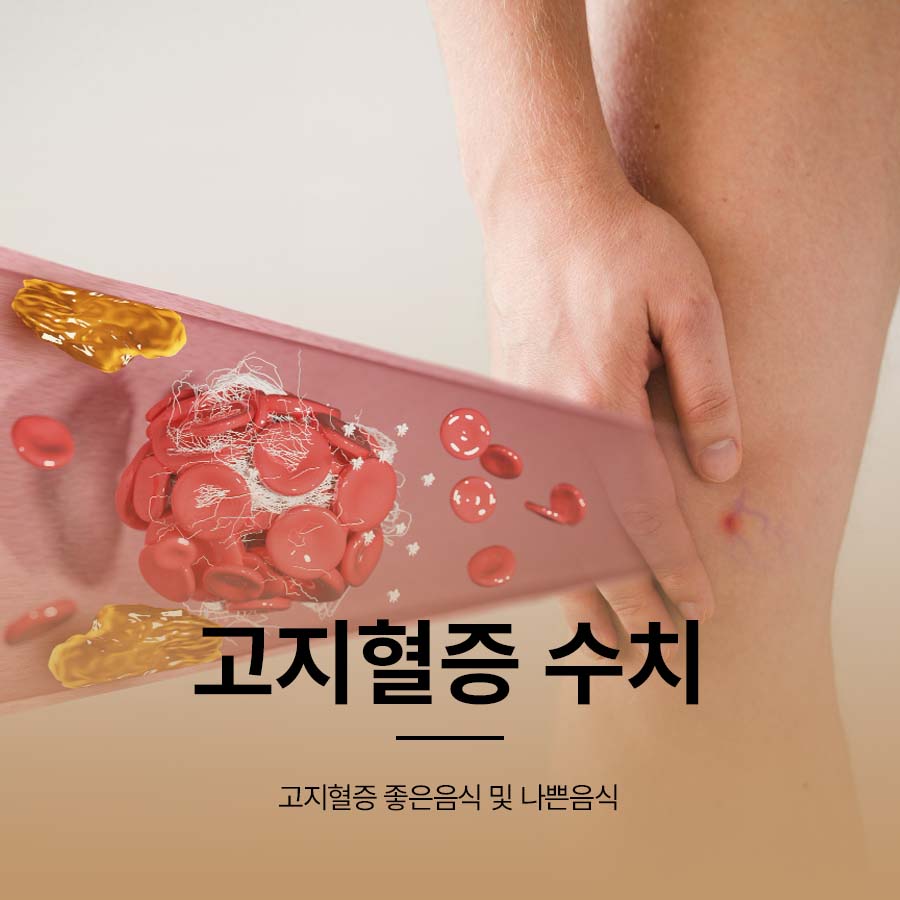 고지혈증 수치 좋은음식 및 나쁜음식 관련 이미지 1