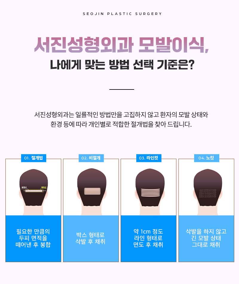 서진 모발이식수술 원리 통증 정리 관련 이미지 3