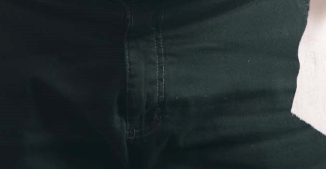 헤어라인모발이식 잘하는곳 내게 딱 맞는 비율로 관련 이미지 32