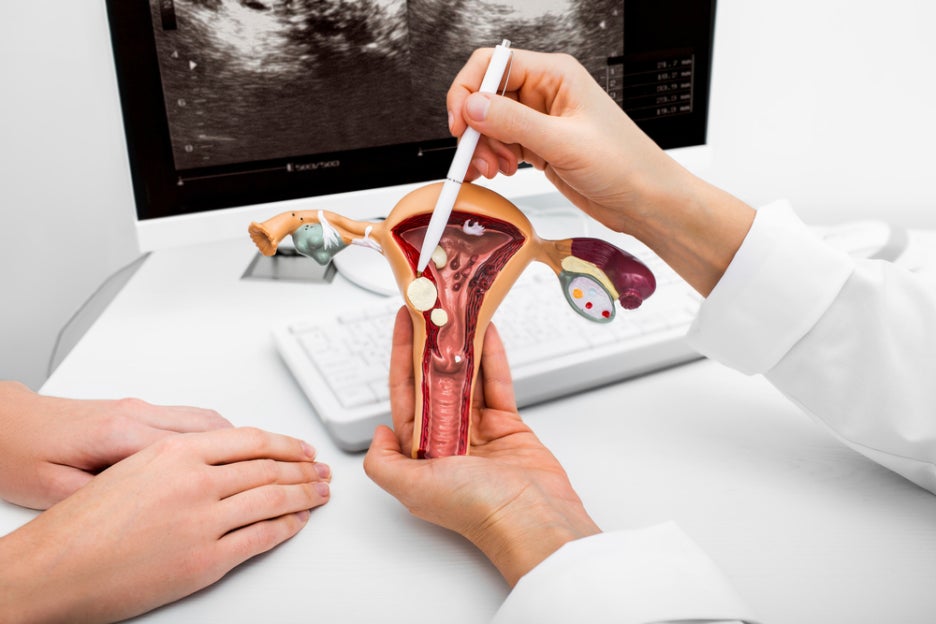 A Complete Guide to Mirena’s Contraceptive Effect: From Procedure to Precautions and Cost! image 8