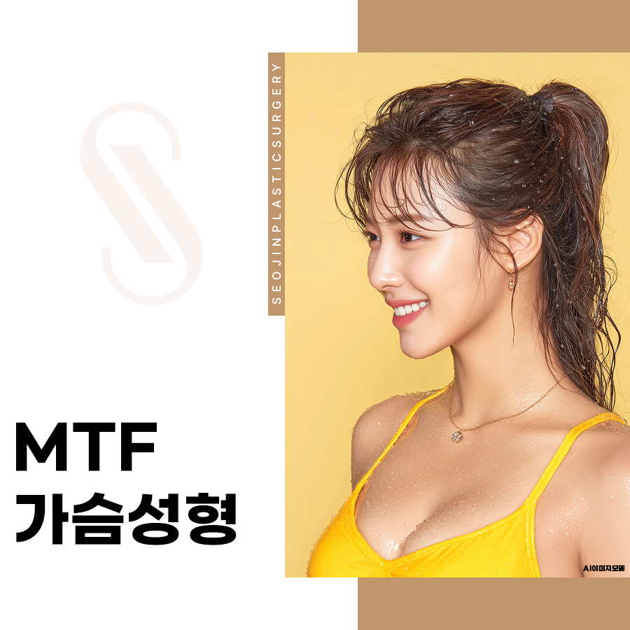 MTF 가슴성형,수술 전 알아두면 좋은 정보 정리 관련 이미지 1