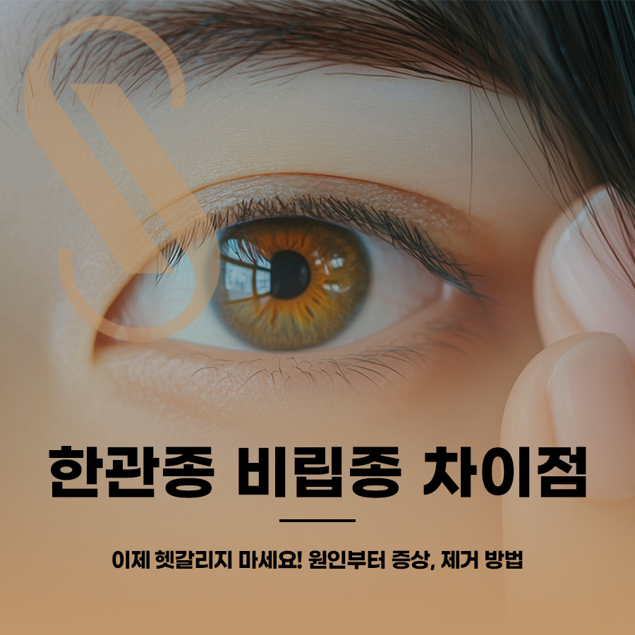 한관종 비립종 차이점, 이제 헷갈리지 마세요! 원인부터 증상, 제거 방법 관련 이미지 1