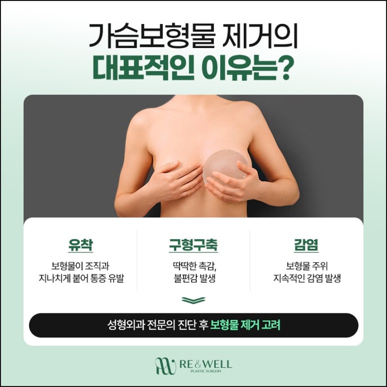 역삼보형물제거잘하는곳 결정 전 알아두면 좋은 정보 관련 이미지 3