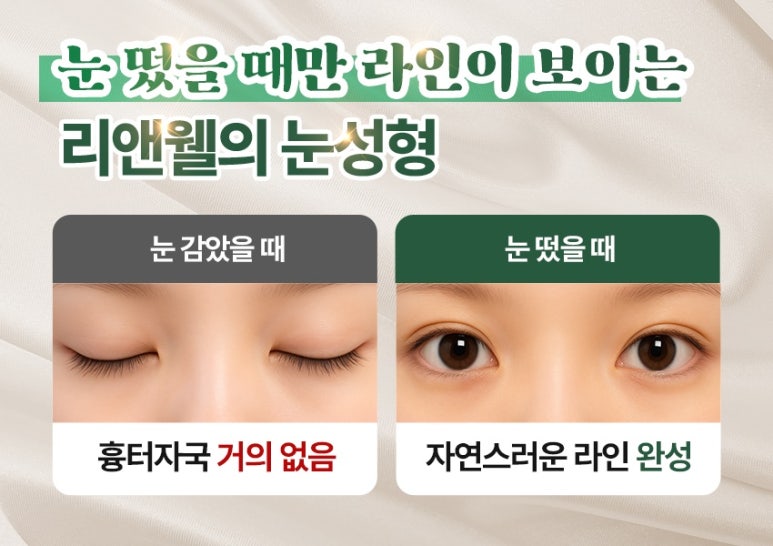 역삼역눈재수술 눈수술 후 후회된다면, 재수술 전에 꼭 읽어보세요 관련 이미지 4