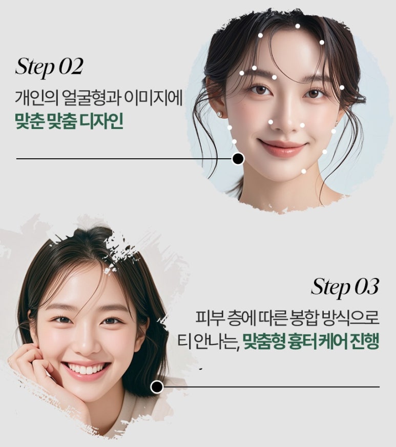 역삼역눈재수술 눈수술 후 후회된다면, 재수술 전에 꼭 읽어보세요 관련 이미지 6