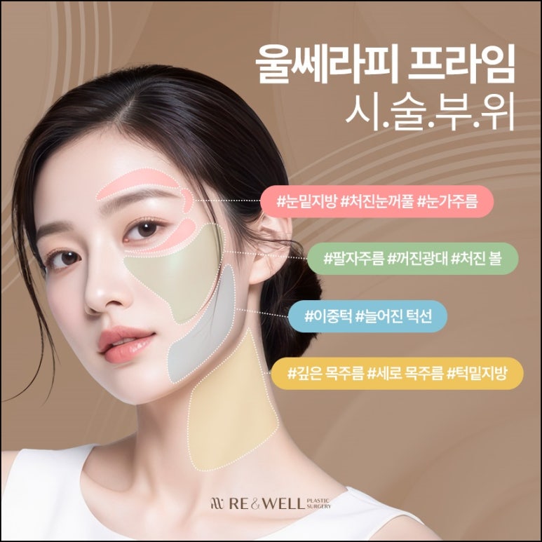Yeoksam-dong Ulthera: From the Principles of Ultherapy Prime to Its Effects image 6
