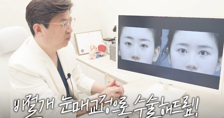 대치동성형외과 눈재수술을 통해 졸린 눈을 또렷한 눈으로 개선하는 과정 관련 이미지 5