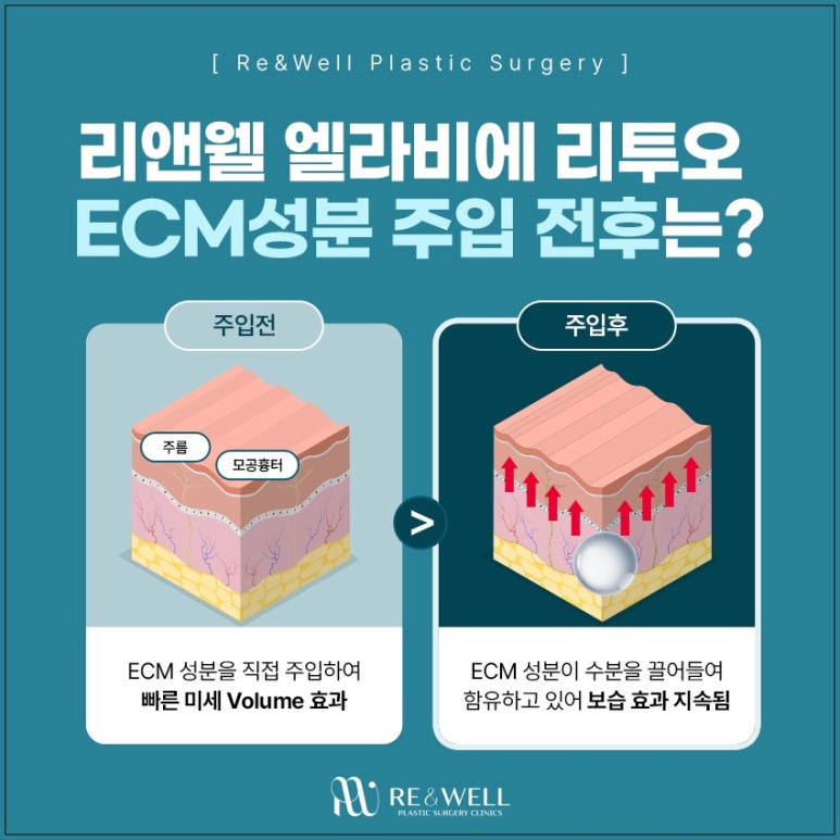 강남 엘라비에 리투오, 효과를 보고 싶다면 관련 이미지 4
