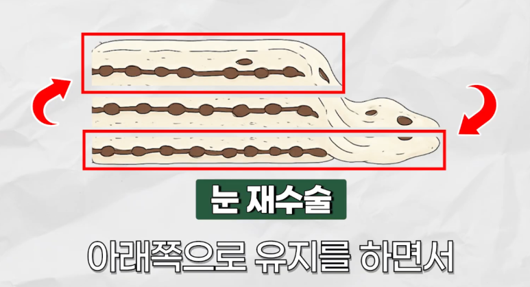 강남 눈재수술 잘하는 곳 리앤웰성형외과에서 시작해보세요 관련 이미지 4