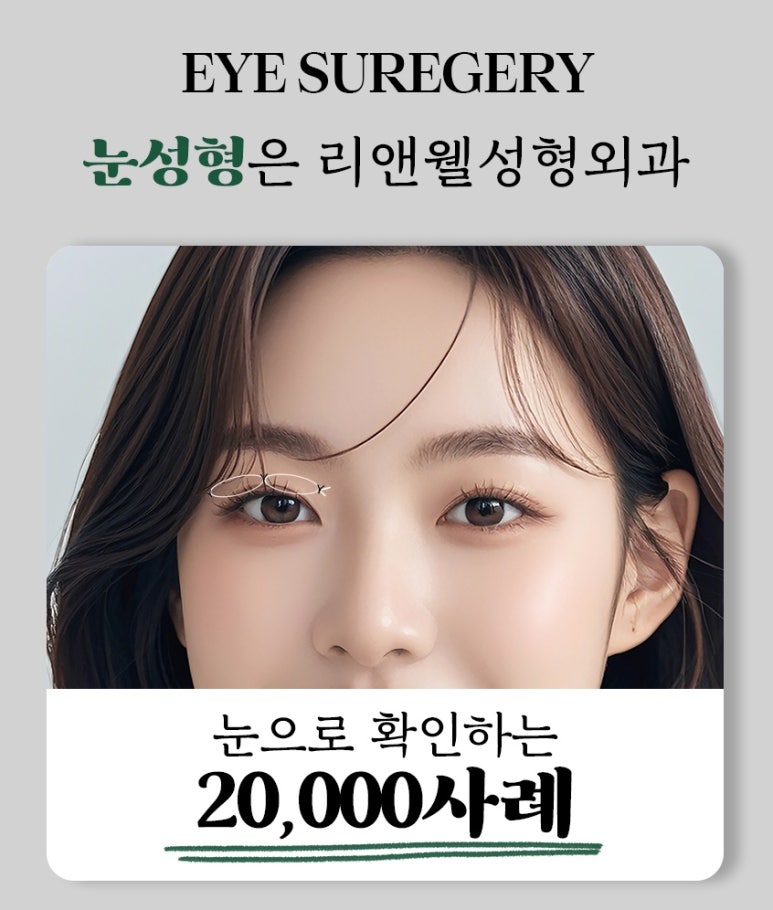 역삼역눈재수술 눈수술 후 후회된다면, 재수술 전에 꼭 읽어보세요 관련 이미지 16