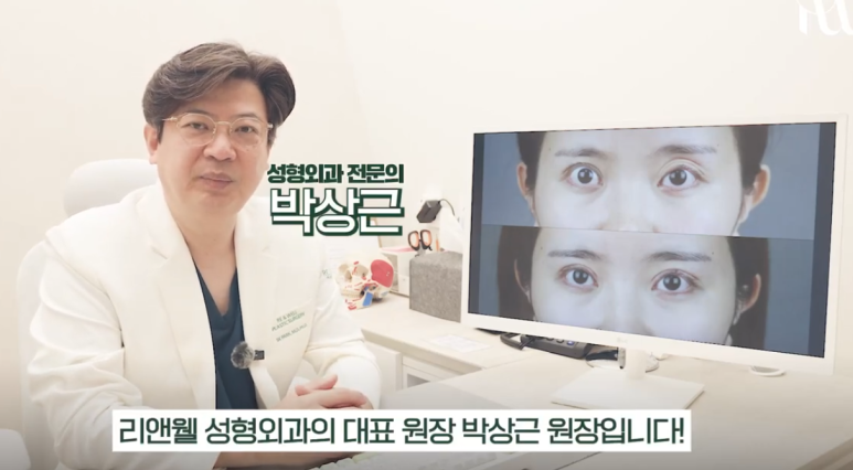 Gangnam Station Double Eyelid Revision Surgery: Let’s Look at Extreme Eye Cases (White-Eyed Appearance, Multiple Fold Creases) image 2