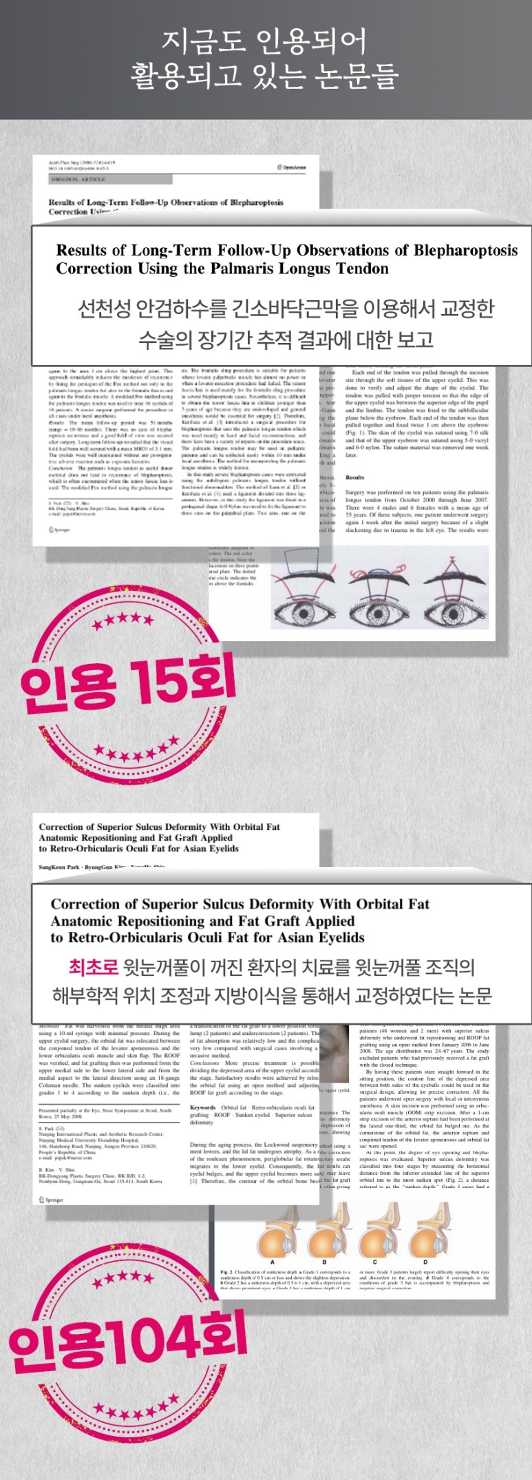 신논현역눈재수술 쌍꺼풀재수술잘하는병원 찾고 있다면 관련 이미지 16